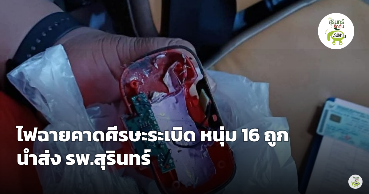 ระทึกกลางดึก ไฟฉายคาดศีรษะระเบิดใส่หนุ่มวัย 16 ปี บาดเจ็บสาหัส ตาบอดมองไม่เห็น กู้ภัยรุดช่วยส่ง รพ.สุรินทร์